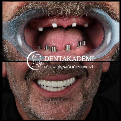 Dental care Before / After photo